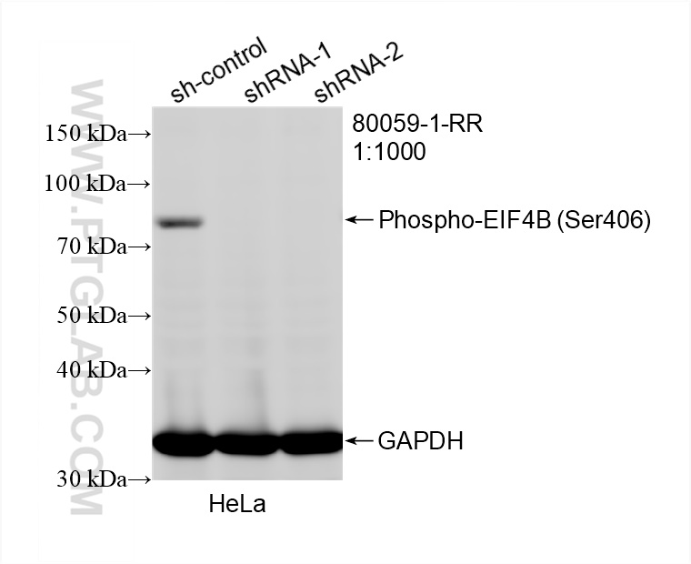 Western Blot (WB) analysis of HeLa cells using Phospho-EIF4B (Ser406) Recombinant antibody (80059-1-RR)