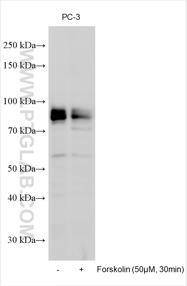 Western Blot (WB) analysis of various lysates using Phospho-FOXO3A (Ser315) Polyclonal antibody (28755-1-AP)