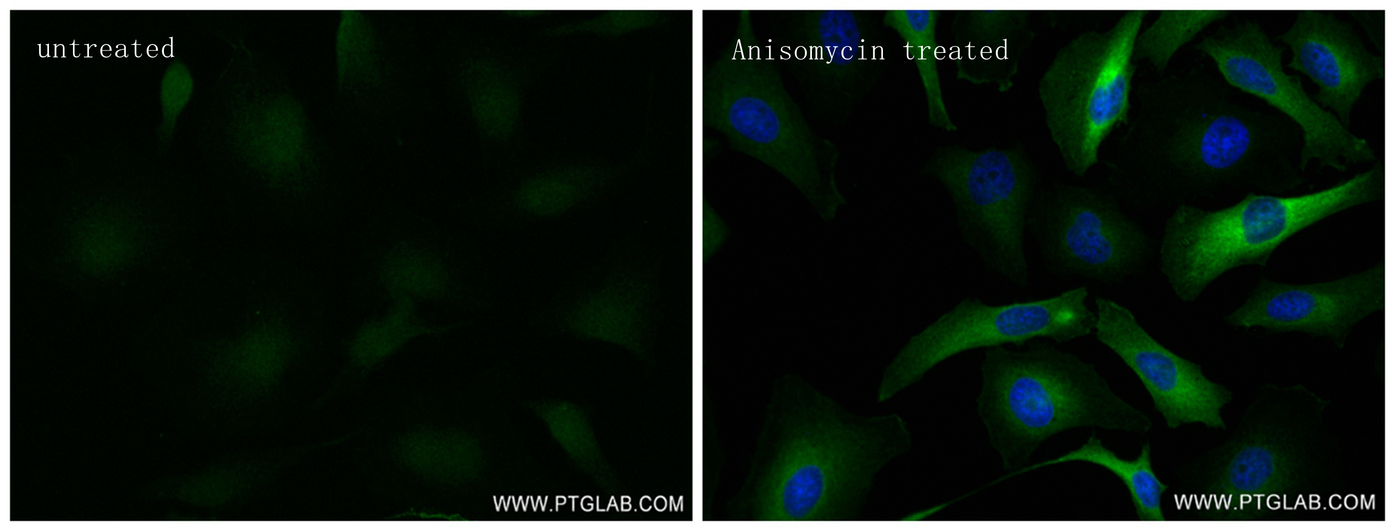 Immunofluorescence (IF) / fluorescent staining of HeLa cells using Phospho-HSP27 (Ser15) Recombinant antibody (83332-3-RR)