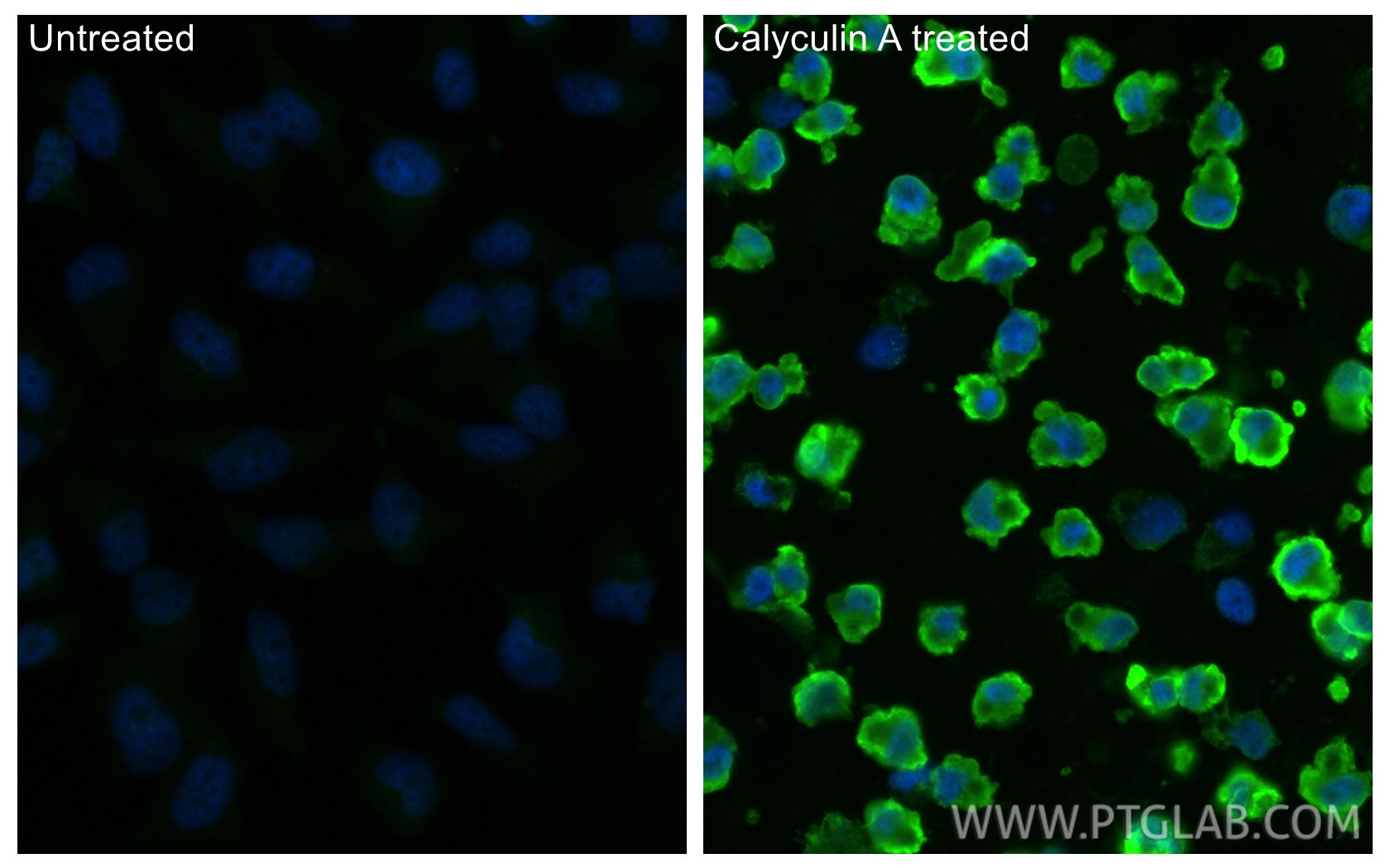 Immunofluorescence (IF) / fluorescent staining of HeLa cells using Phospho-HSP27 (Ser78) Recombinant monoclonal antib (80046-3-RR)