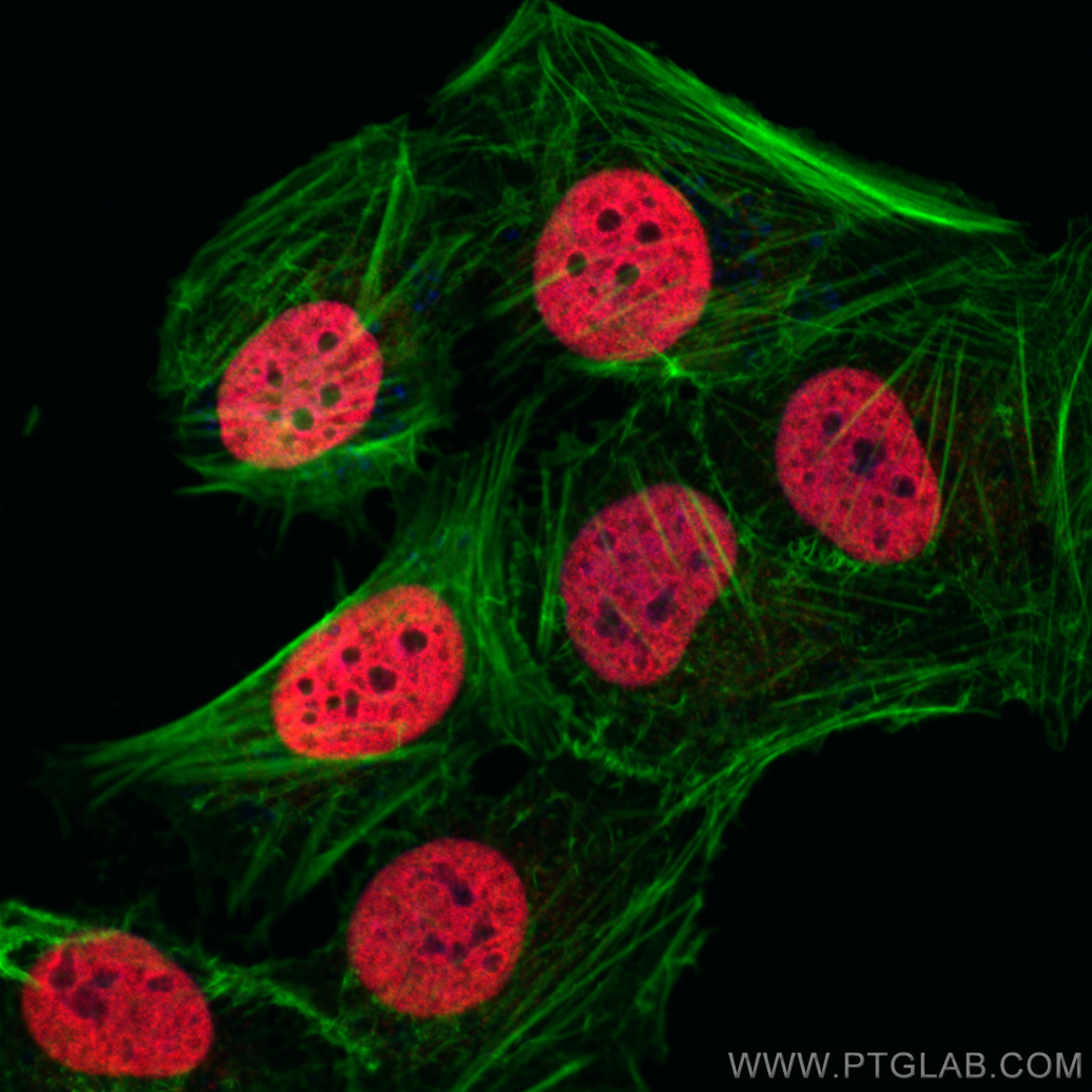 Immunofluorescence (IF) / fluorescent staining of U2OS cells using Phospho-Histone H2A.X (Ser139) Polyclonal antibody (29380-1-AP)