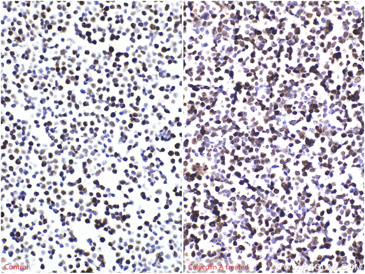 Immunohistochemistry (IHC) staining of Jurkat cells using Phospho-Histone H2A.X (Ser139) Recombinant antibod (83307-2-RR)