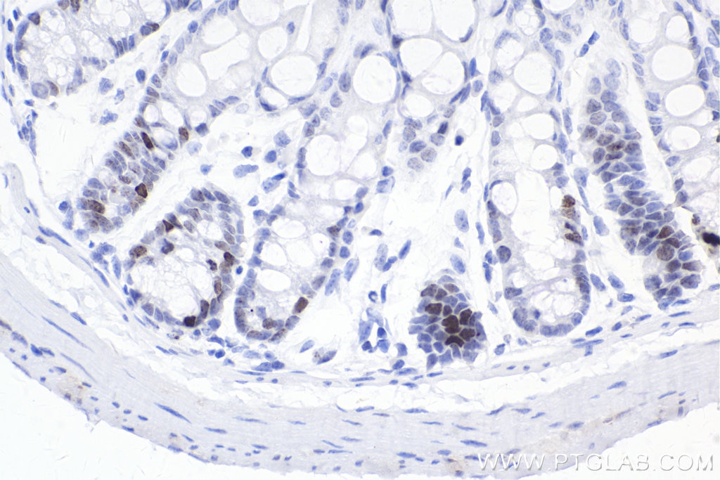 Immunohistochemistry (IHC) staining of mouse colon tissue using Phospho-Histone H2A.X (Ser139) Recombinant monoclo (83307-2-RR)