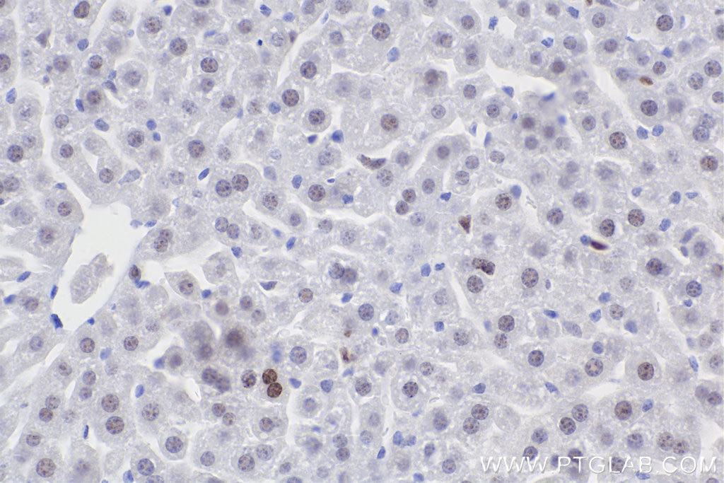Immunohistochemistry (IHC) staining of mouse liver tissue using Phospho-Histone H2A.X (Ser139) Recombinant monoclo (83307-2-RR)