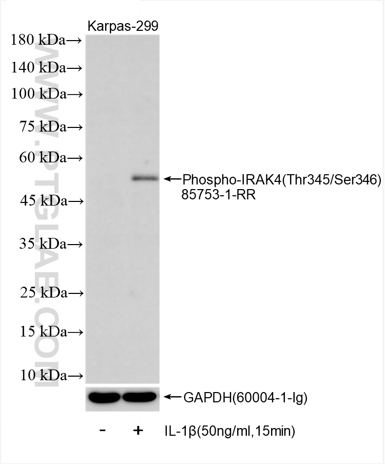 Western Blot (WB) analysis of Karpas-299 cells using Phospho-IRAK4 (Thr345/Ser346) Recombinant antibody (85753-1-RR)