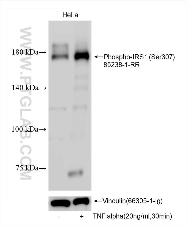 Western Blot (WB) analysis of various lysates using Phospho-IRS1 (Ser307) Recombinant antibody (85238-1-RR)