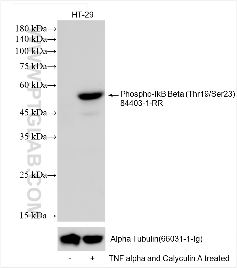 Phospho-IkB Beta (Thr19/Ser23)