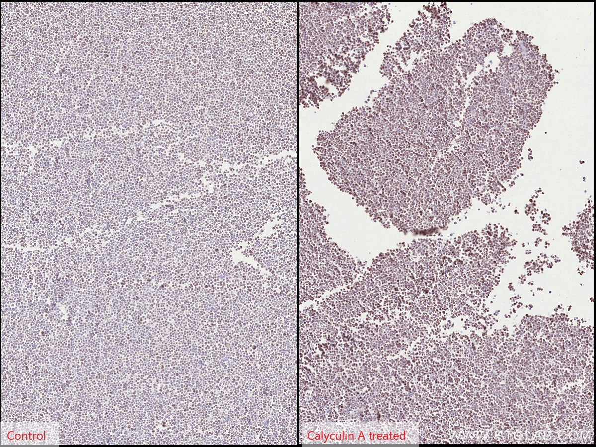 Immunohistochemistry (IHC) staining of Jurkat cells using Phospho-JNK (Thr183/Tyr185) Monoclonal antibody (60666-1-Ig)