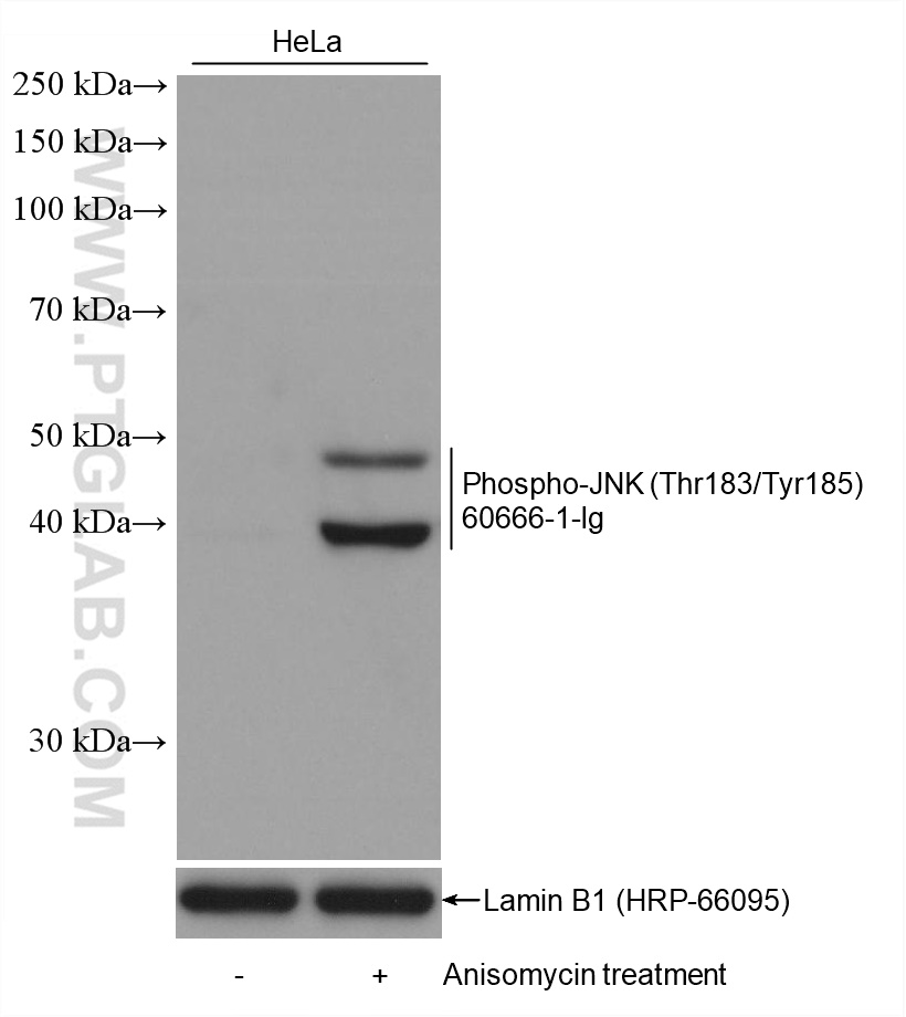 Western Blot (WB) analysis of various lysates using Phospho-JNK (Thr183/Tyr185) Monoclonal antibody (60666-1-Ig)