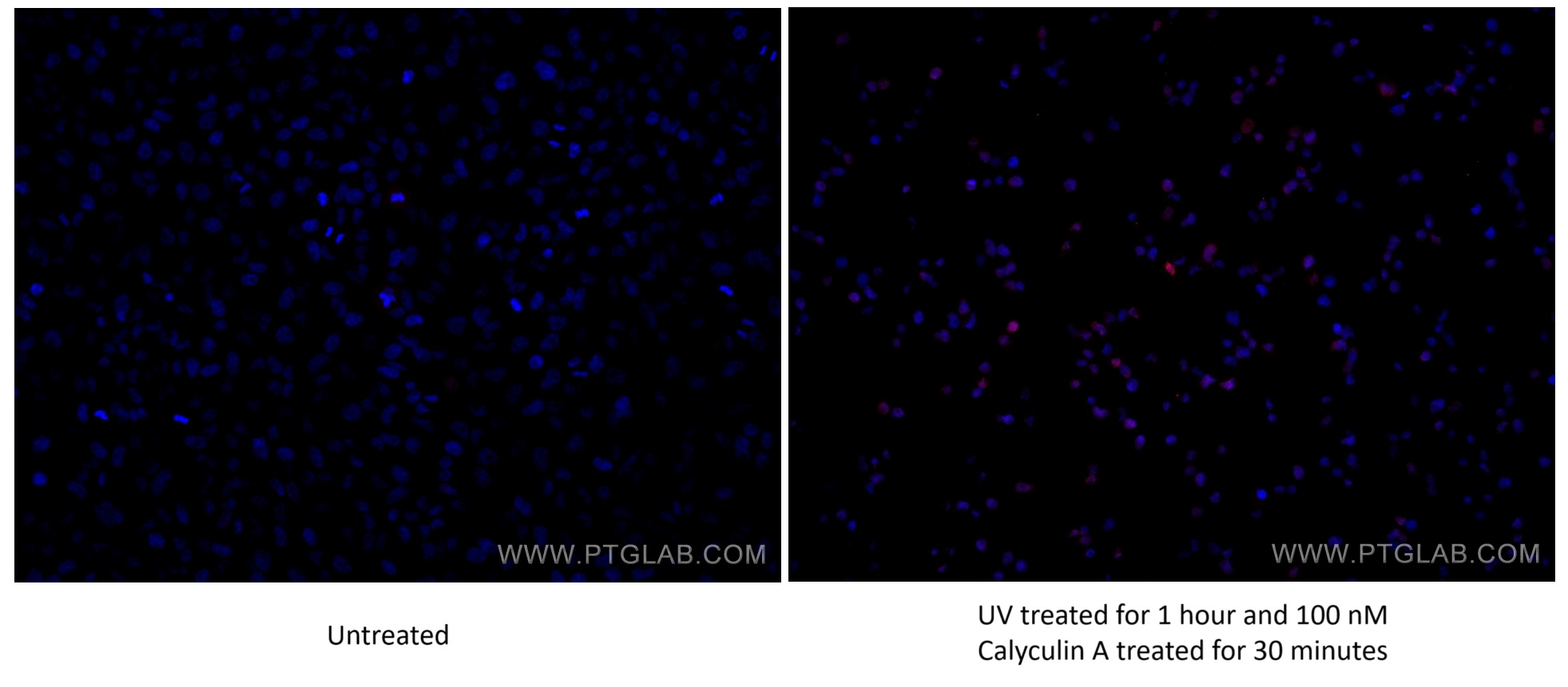 Immunofluorescence (IF) / fluorescent staining of HeLa cells using Phospho-JUN (Ser73) Recombinant antibody (80086-1-RR)