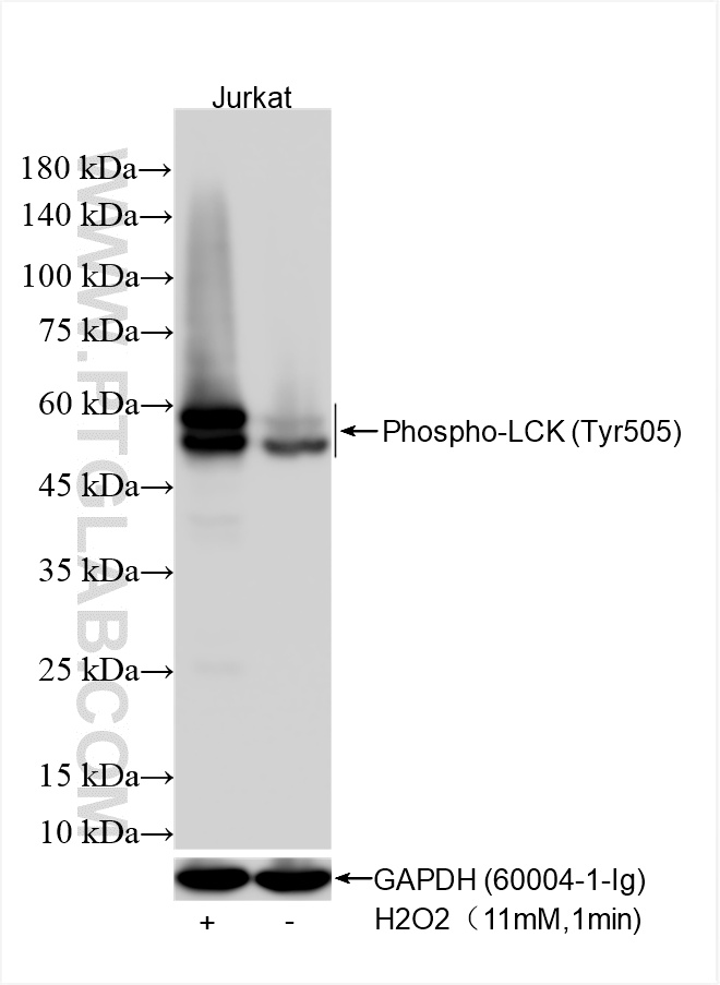 Western Blot (WB) analysis of various lysates using Phospho-LCK (Tyr505) Recombinant antibody (85679-1-RR)