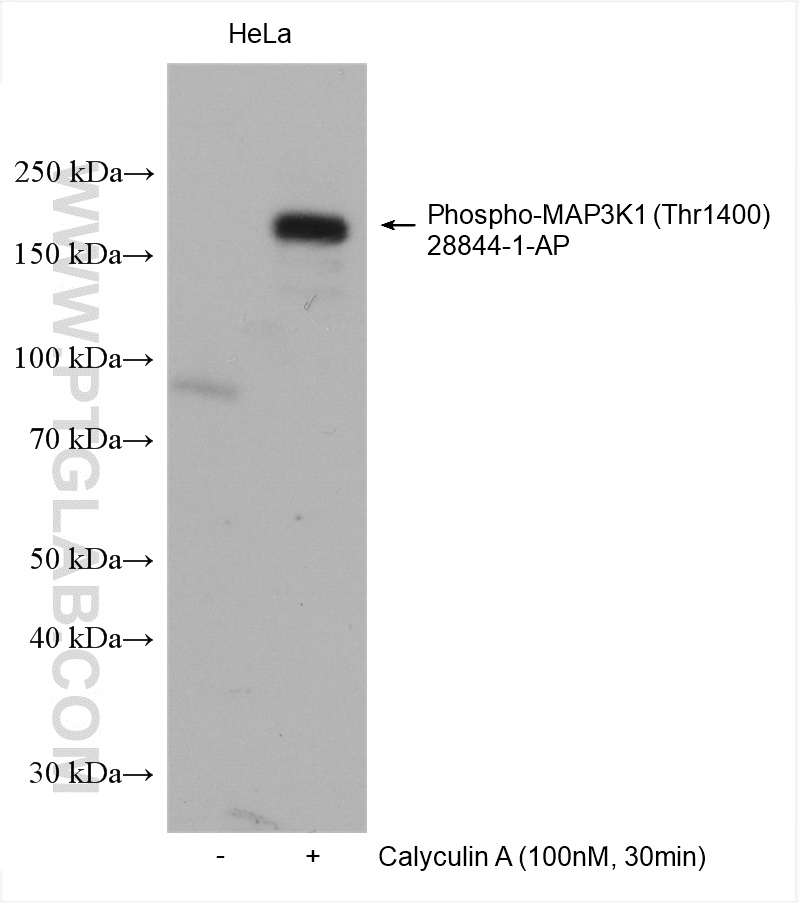 Western Blot (WB) analysis of various lysates using Phospho-MAP3K1 (Thr1400) Polyclonal antibody (28844-1-AP)