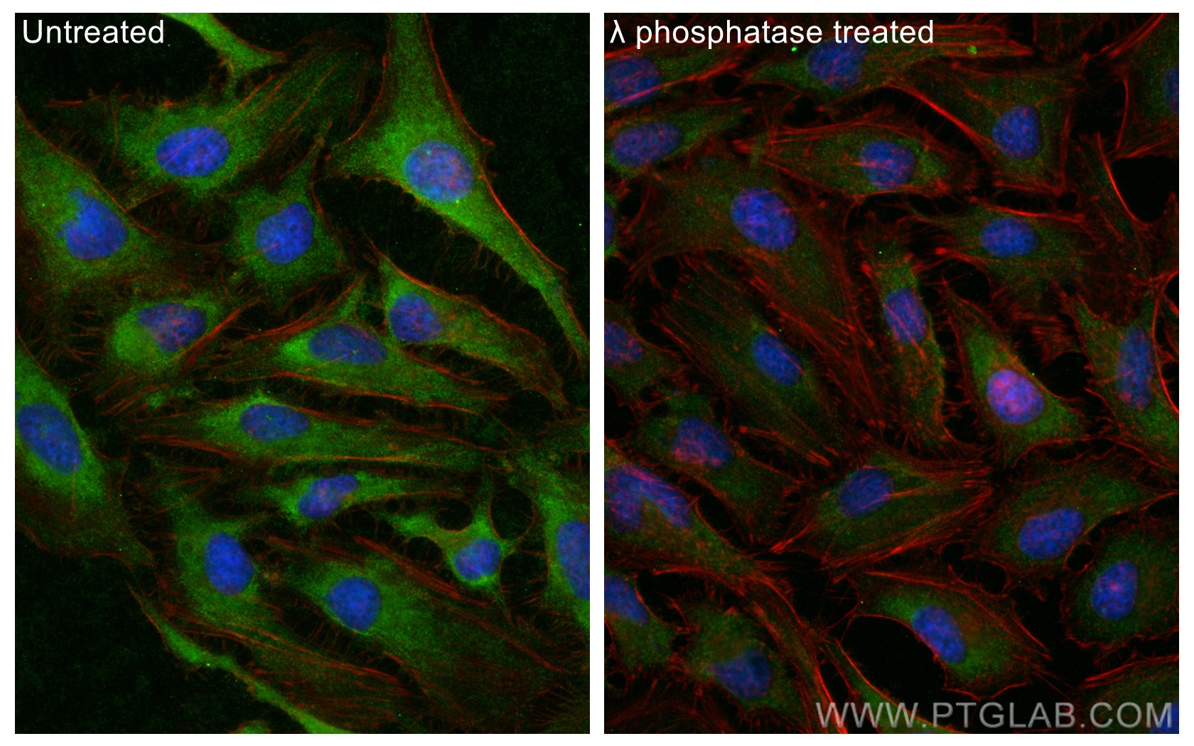 Immunofluorescence (IF) / fluorescent staining of HeLa cells using Phospho-MARCKS (Ser167/170) Polyclonal antibody (29145-1-AP)