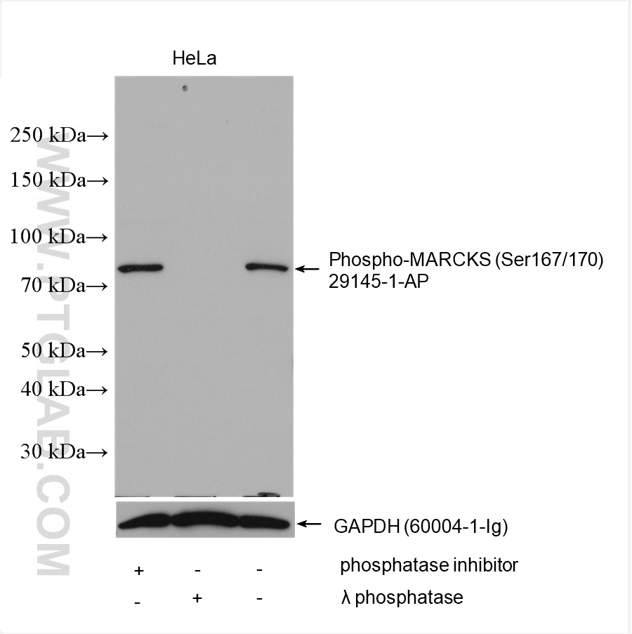 Western Blot (WB) analysis of HeLa cells using Phospho-MARCKS (Ser167/170) Polyclonal antibody (29145-1-AP)