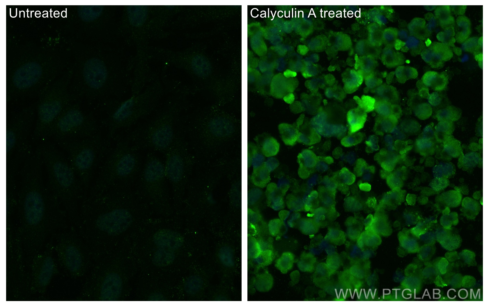 Immunofluorescence (IF) / fluorescent staining of HeLa cells using Phospho-MEK1 (Thr386) Monoclonal antibody (68015-1-Ig)