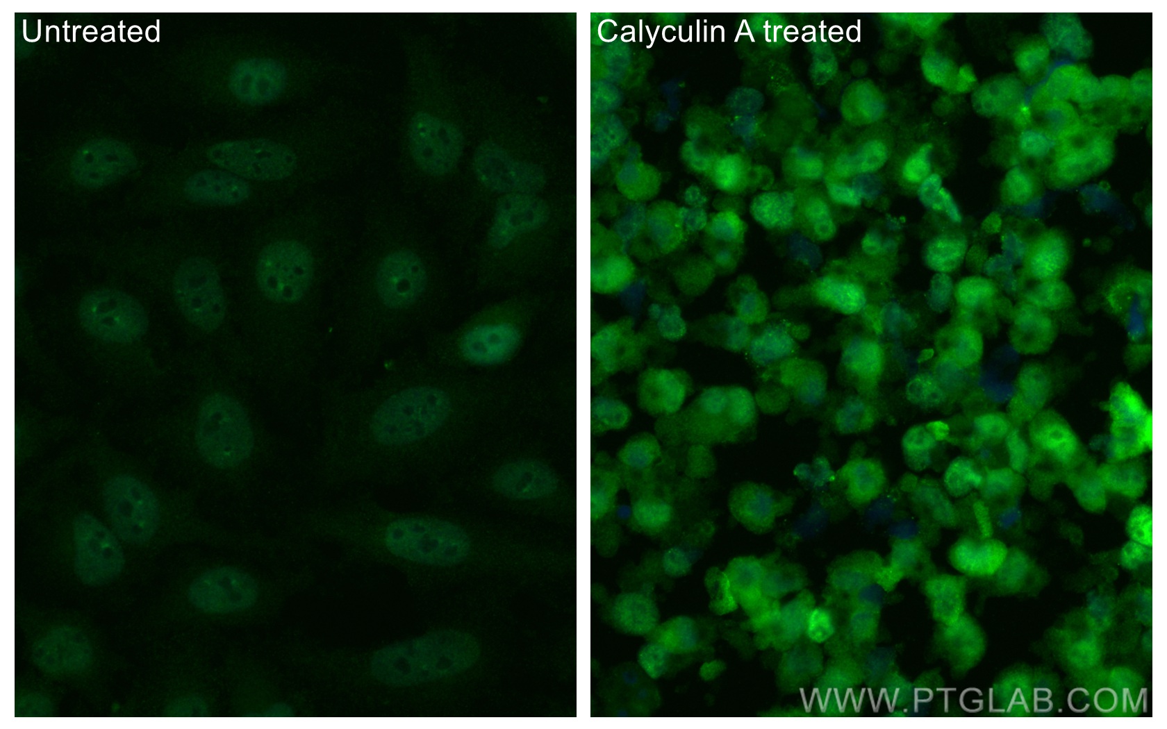 Immunofluorescence (IF) / fluorescent staining of HeLa cells using CoraLite® Plus 488-conjugated Phospho-MEK1 (Thr386 (CL488-68015)