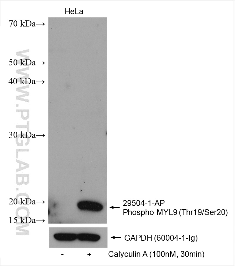 Western Blot (WB) analysis of various lysates using Phospho-MYL9 (Thr19/Ser20)  Polyclonal antibody (29504-1-AP)