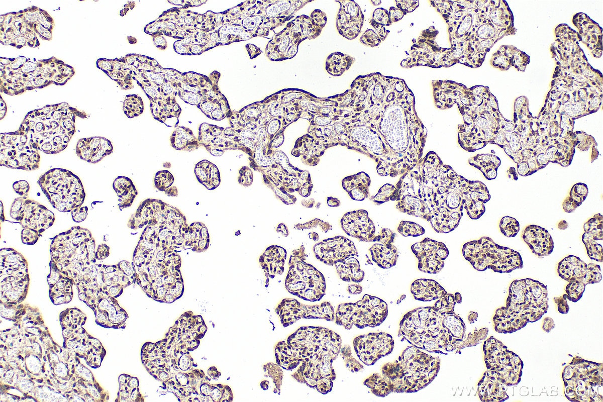 Immunohistochemistry (IHC) staining of human placenta tissue using Phospho-NF-κB p65 (Ser536) Recombinant monoclonal (80379-2-RR)