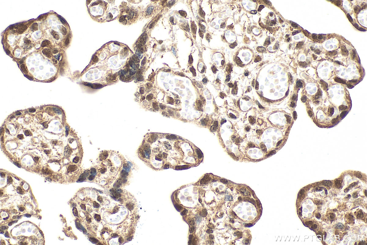 Immunohistochemistry (IHC) staining of human placenta tissue using Phospho-NF-κB p65 (Ser536) Recombinant monoclonal (80379-2-RR)