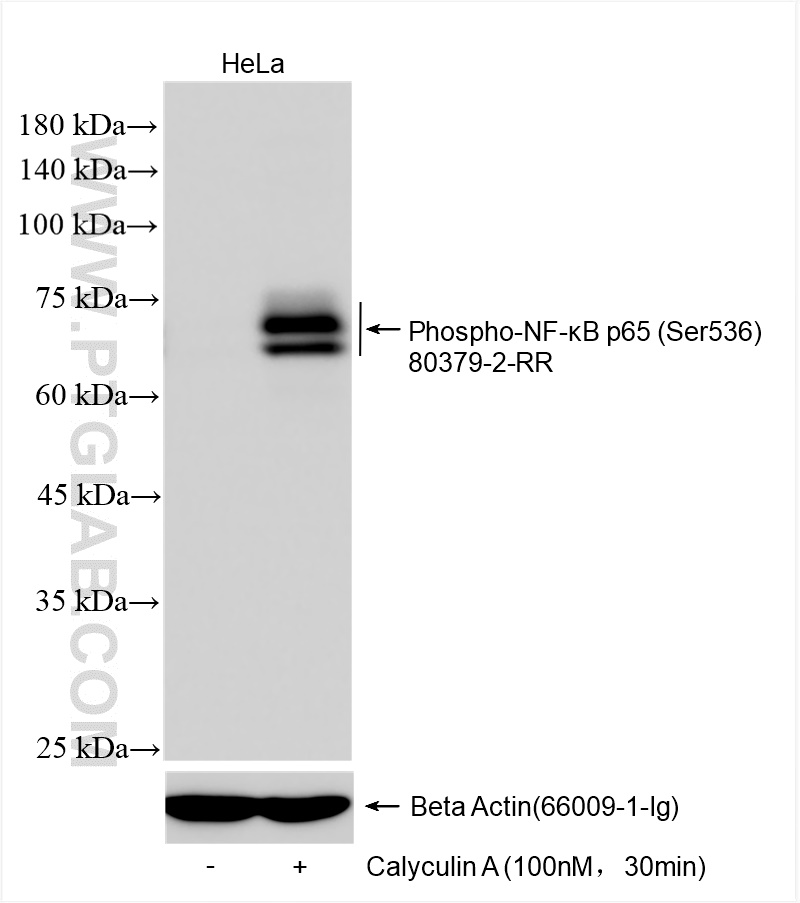 Western Blot (WB) analysis of various lysates using Phospho-NF-κB p65 (Ser536) Recombinant antibody (80379-2-RR)