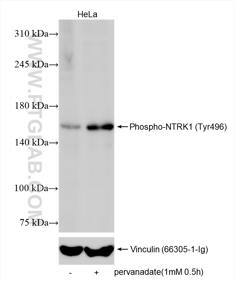 Western Blot (WB) analysis of various lysates using Phospho-NTRK1 (Tyr496) Recombinant antibody (84976-1-RR)