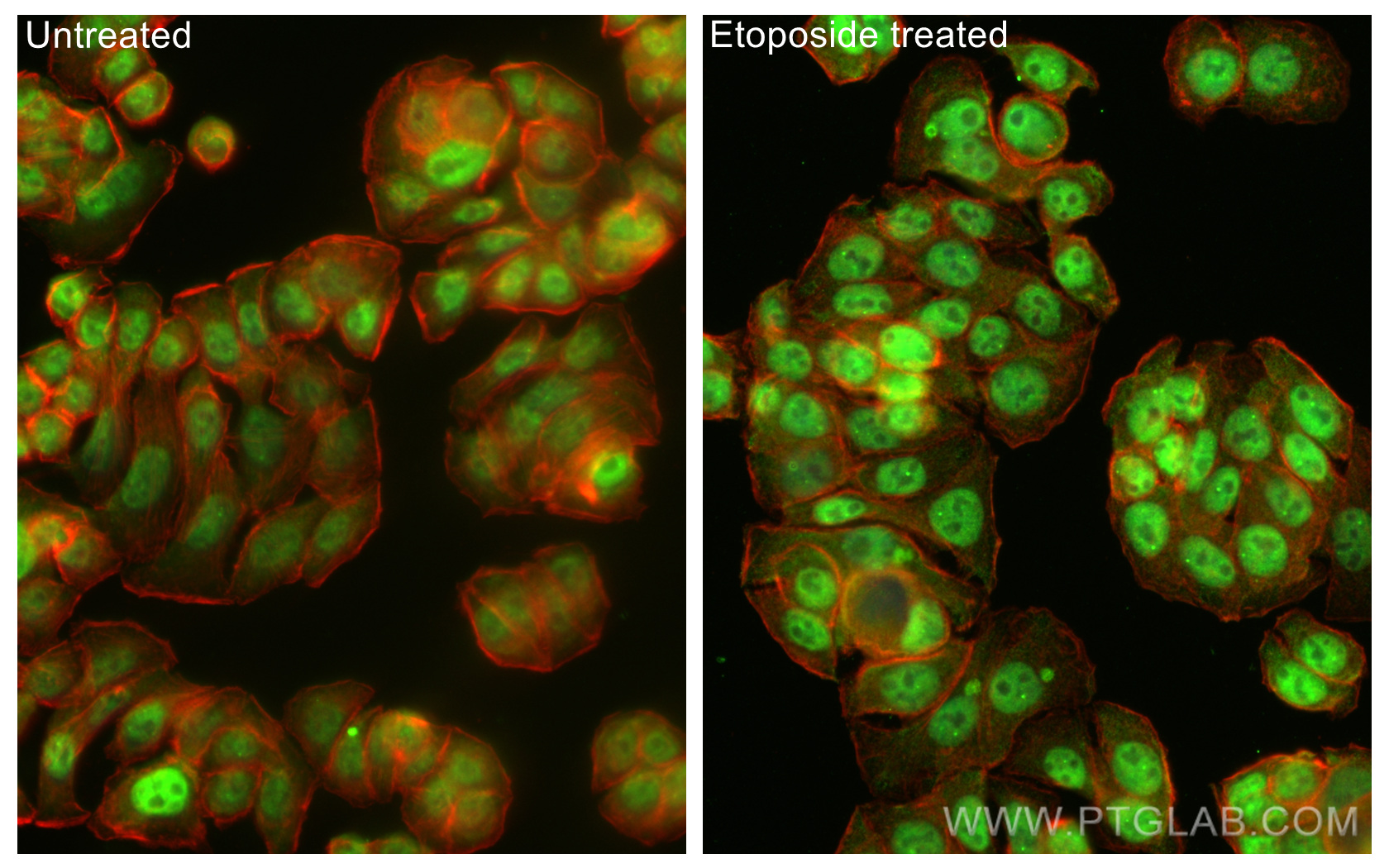 Immunofluorescence (IF) / fluorescent staining of HT-29 cells using Phospho-P53 (Ser15) Monoclonal antibody (67826-1-Ig)