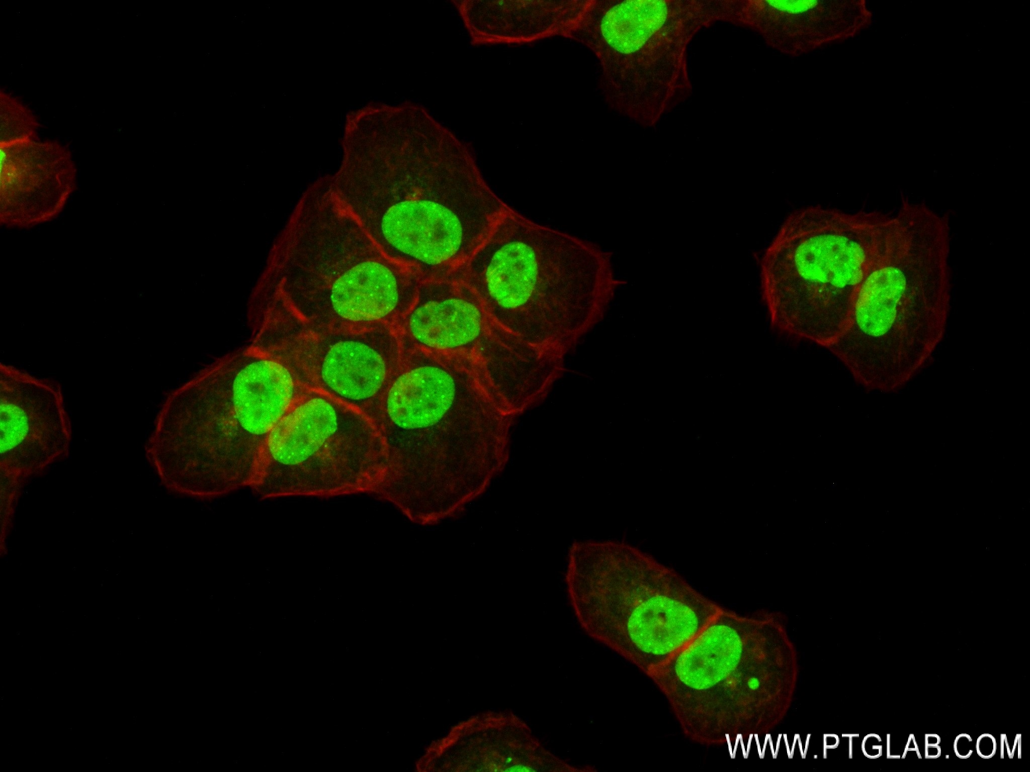 Immunofluorescence (IF) / fluorescent staining of A431 cells using Phospho-P53 (Ser392) Recombinant antibody (80077-2-RR)