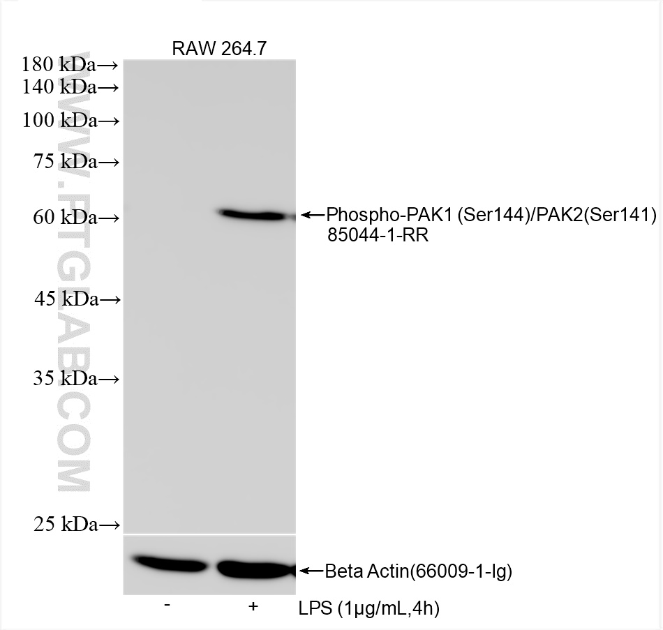 Western Blot (WB) analysis of various lysates using Phospho-PAK1 (Ser144)/PAK2 (Ser141) Recombinant an (85044-1-RR)