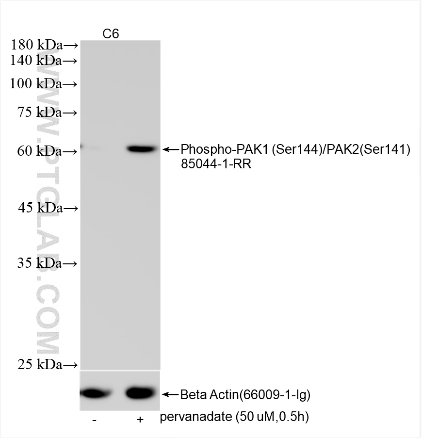 Western Blot (WB) analysis of various lysates using Phospho-PAK1 (Ser144)/PAK2 (Ser141) Recombinant an (85044-1-RR)