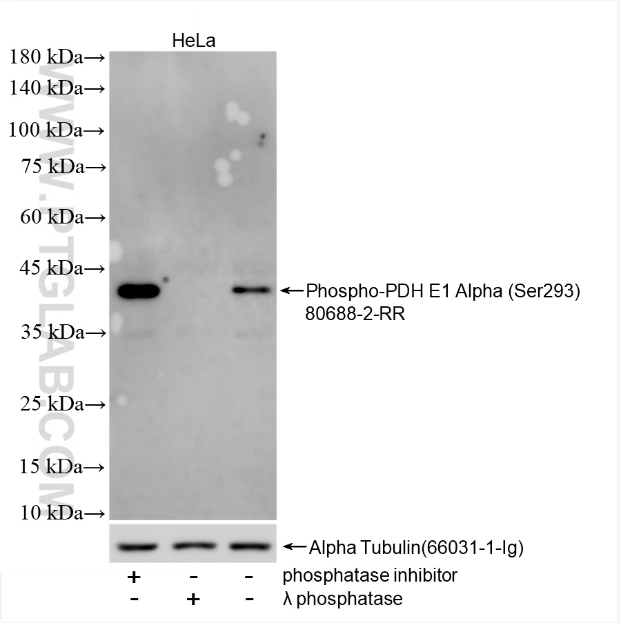 Western Blot (WB) analysis of various lysates using Phospho-PDH E1 Alpha (Ser293) Recombinant antibody (80688-2-RR)