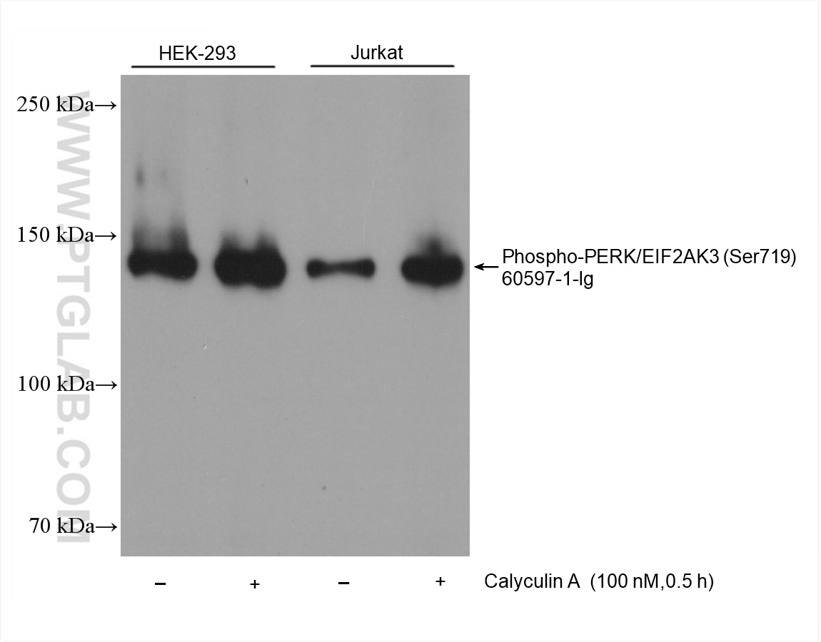 Western Blot (WB) analysis of various lysates using Phospho-PERK/EIF2AK3 (Ser719) Monoclonal antibody (60597-1-Ig)