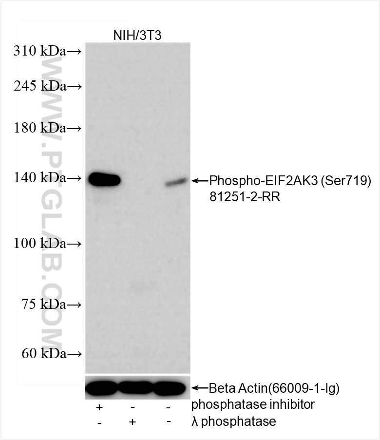Western Blot (WB) analysis of various lysates using Phospho-PERK/EIF2AK3 (Ser719) Recombinant antibody (81251-2-RR)
