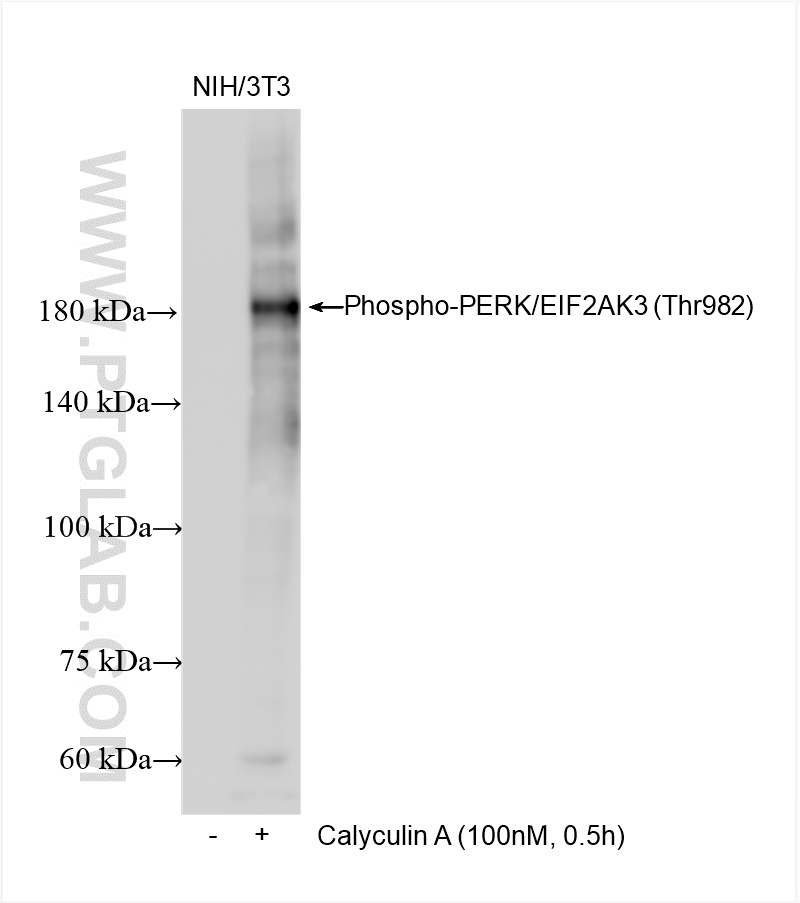 Western Blot (WB) analysis of various lysates using Phospho-PERK/EIF2AK3 (Thr982) Recombinant antibody (82534-1-RR)