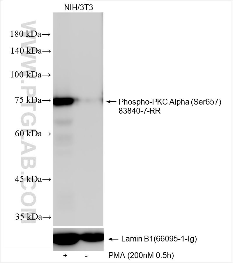Western Blot (WB) analysis of various lysates using Phospho-PKC Alpha (Ser657) Recombinant antibody (83840-7-RR)