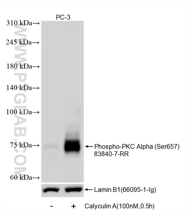 Western Blot (WB) analysis of various lysates using Phospho-PKC Alpha (Ser657) Recombinant antibody (83840-7-RR)