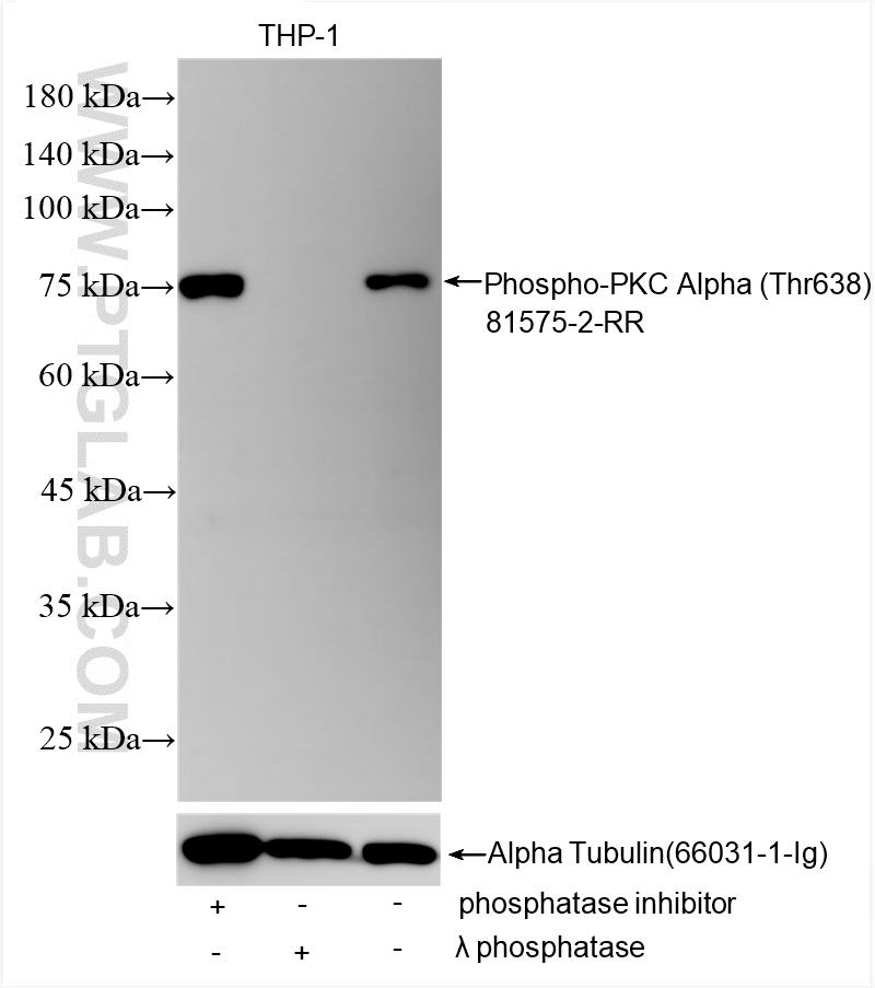 Western Blot (WB) analysis of various lysates using Phospho-PKC Alpha (Thr638) Recombinant antibody (81575-2-RR)