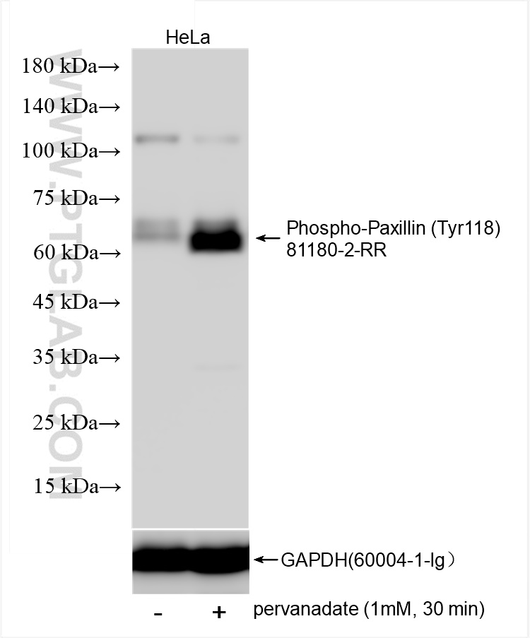 Western Blot (WB) analysis of various lysates using Phospho-Paxillin (Tyr118) Recombinant antibody (81180-2-RR)