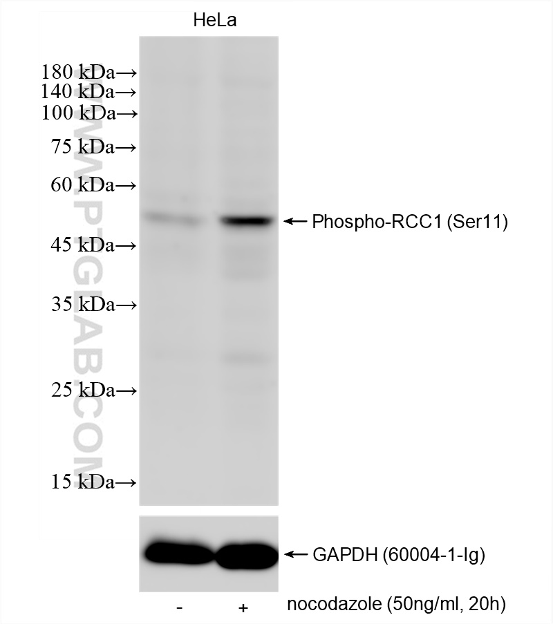 Western Blot (WB) analysis of HeLa cells using Phospho-RCC1 (Ser11) Recombinant antibody (83630-1-RR)