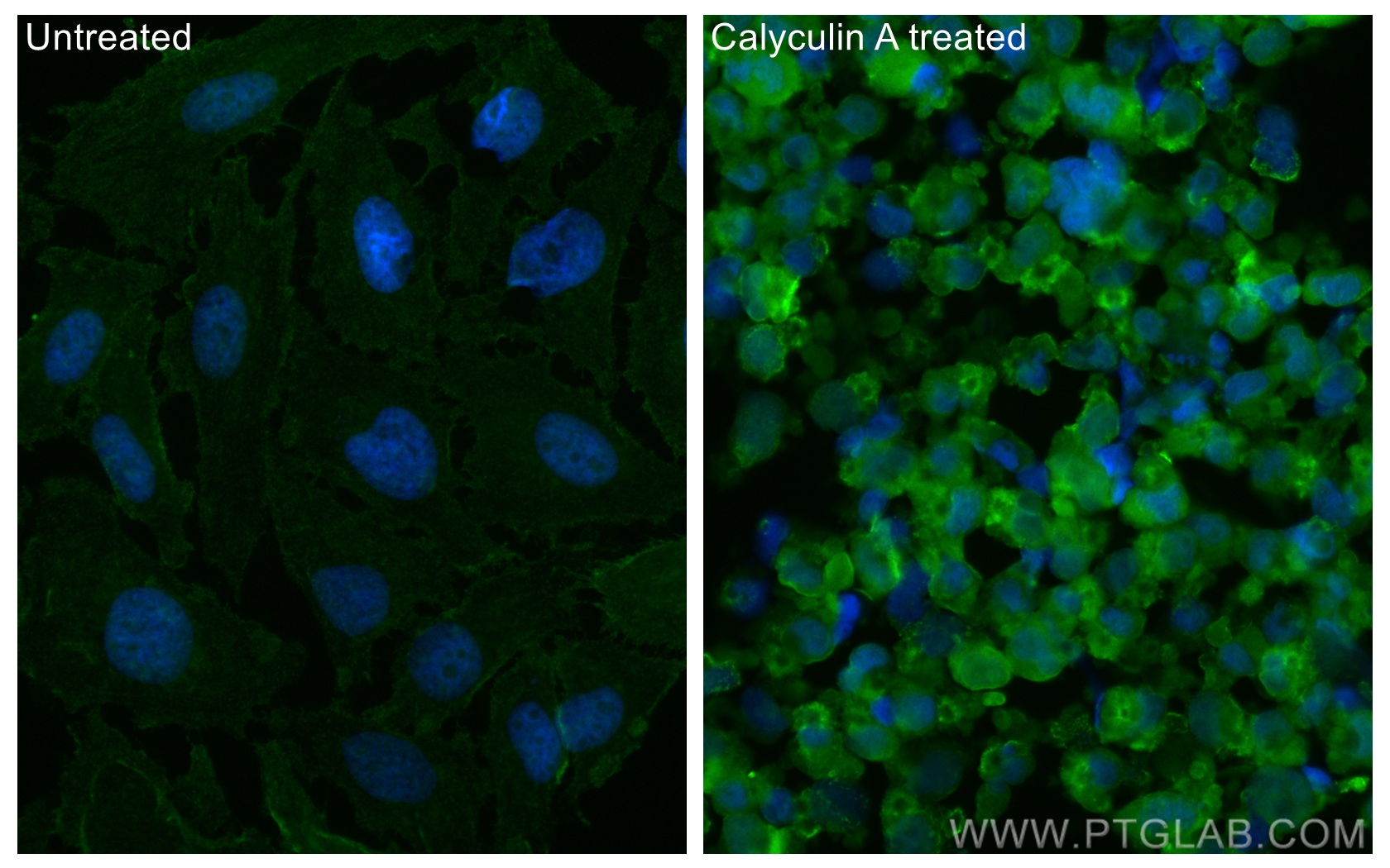 Immunofluorescence (IF) / fluorescent staining of HeLa cells using CoraLite® Plus 488-conjugated Phospho-RIPK1 (Ser16 (CL488-66854)