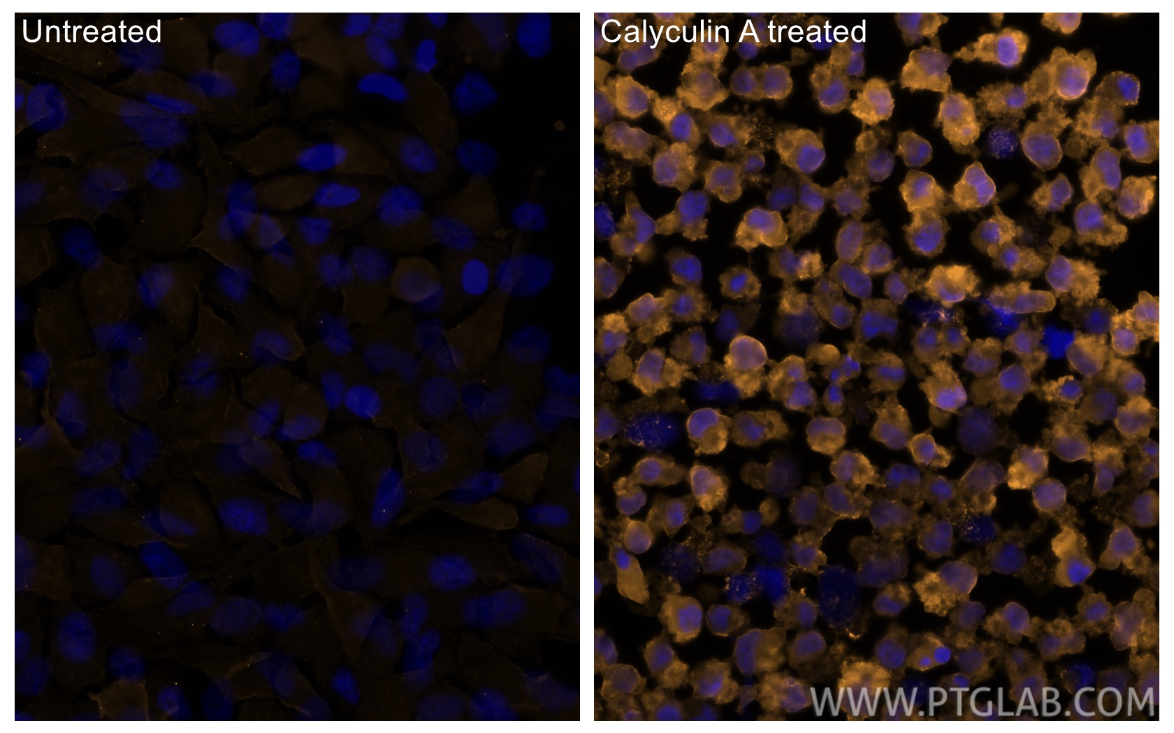 Immunofluorescence (IF) / fluorescent staining of HeLa cells using CoraLite®555-conjugated Phospho-RIPK1 (Ser161)  Mo (CL555-66854)