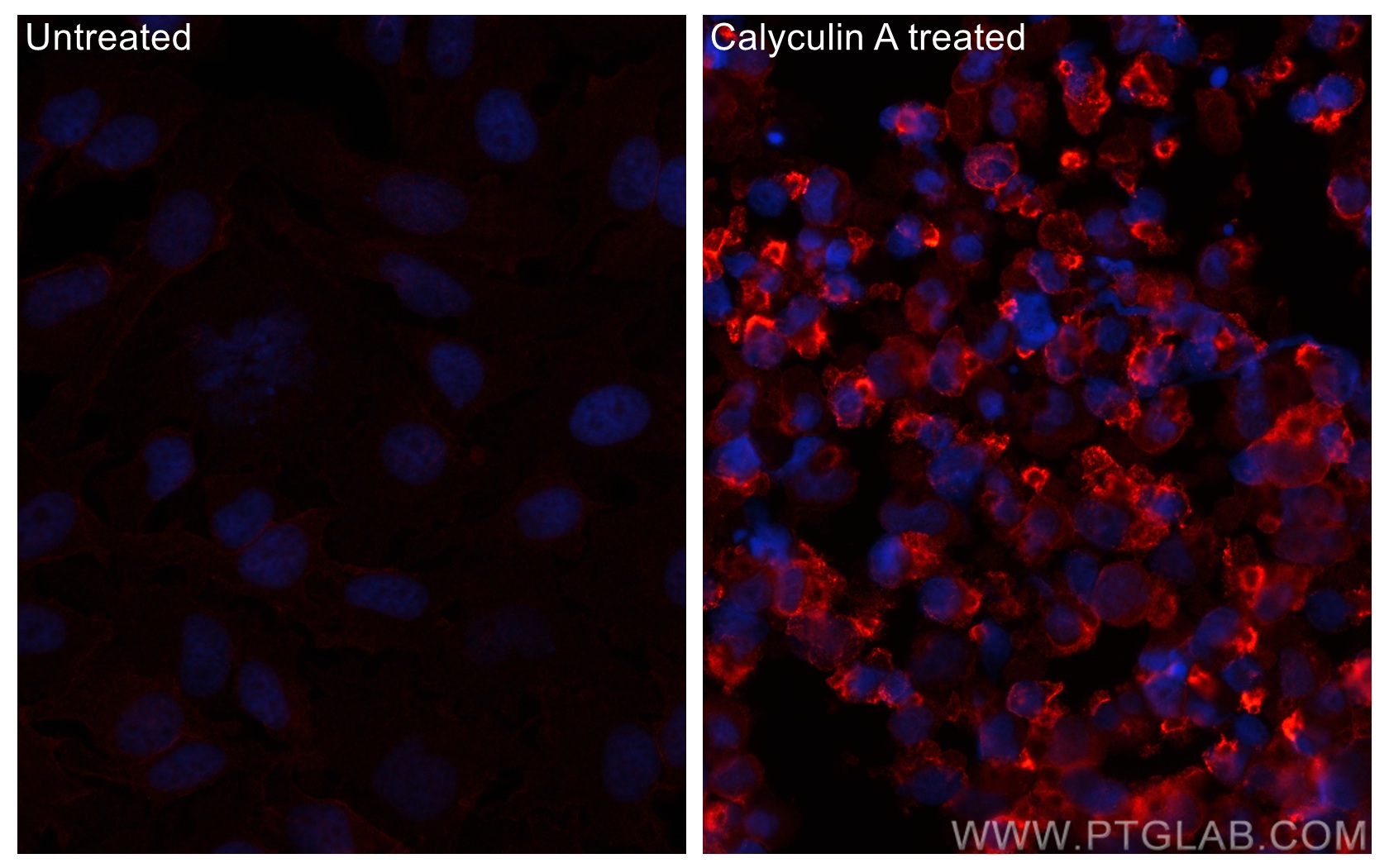 Immunofluorescence (IF) / fluorescent staining of HeLa cells using CoraLite®594-conjugated Phospho-RIPK1 (Ser161)  Mo (CL594-66854)