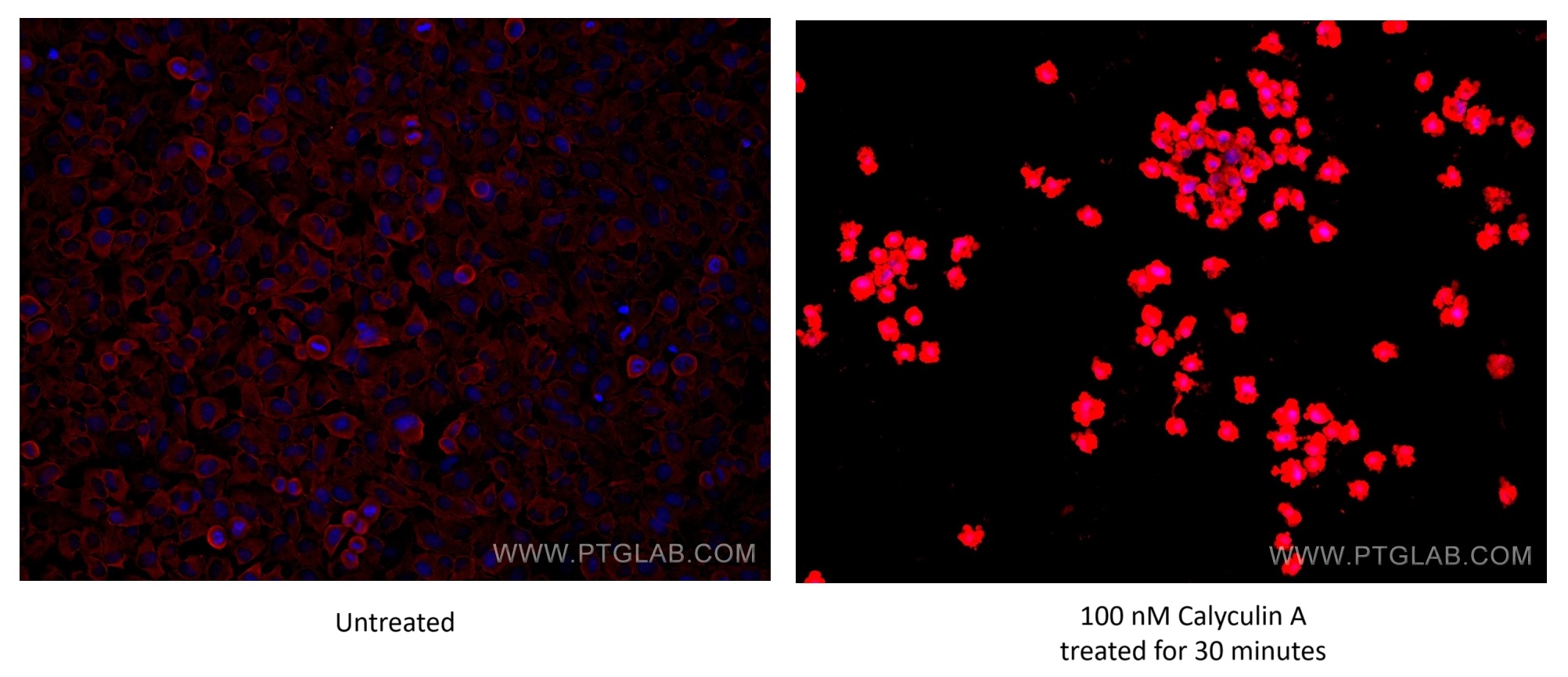 Immunofluorescence (IF) / fluorescent staining of HeLa cells using Phospho-S6 Ribosomal protein (Ser235/236) Recombin (80130-2-RR)