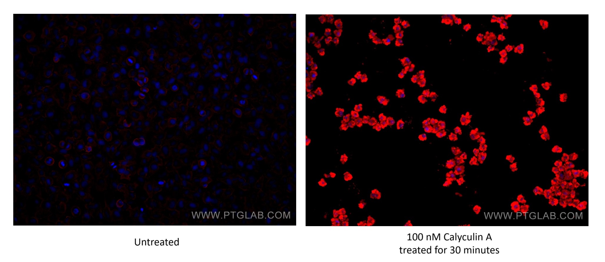 Immunofluorescence (IF) / fluorescent staining of HeLa cells using Phospho-S6 Ribosomal protein (Ser235) Monoclonal a (67898-1-Ig)