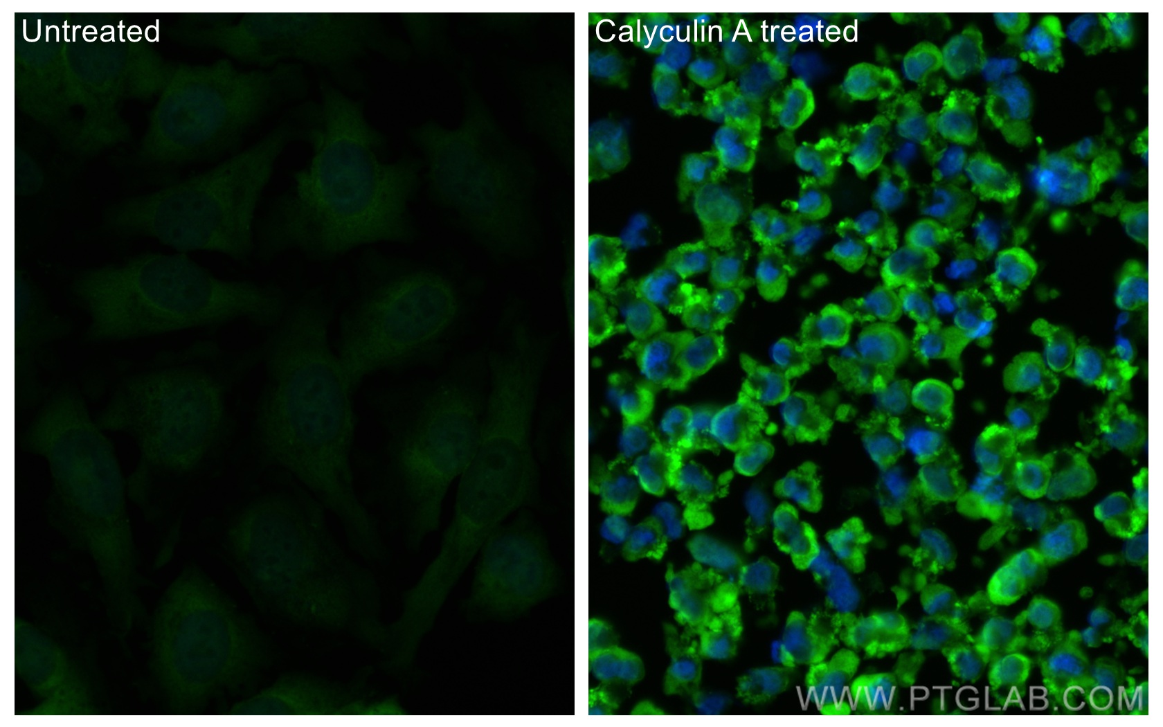 Immunofluorescence (IF) / fluorescent staining of HeLa cells using CoraLite® Plus 488-conjugated Phospho-S6 Ribosomal (CL488-67898)