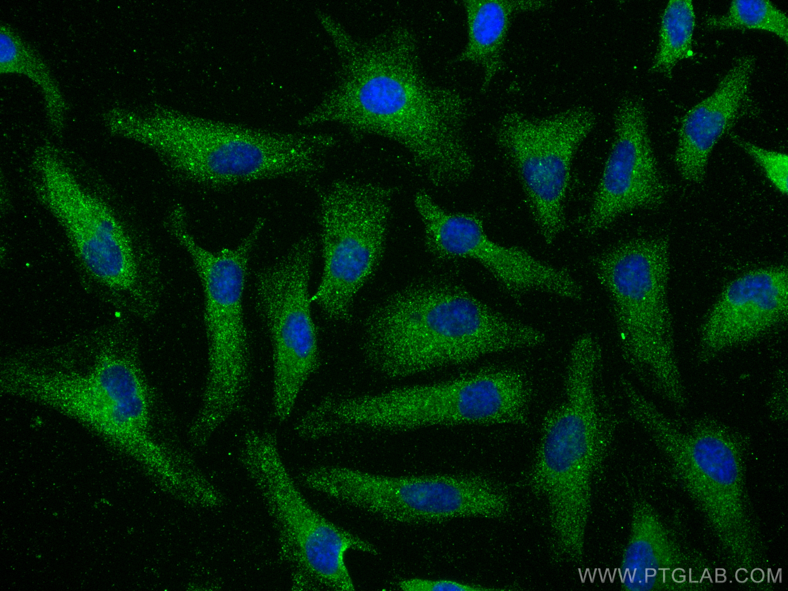 Immunofluorescence (IF) / fluorescent staining of HeLa cells using Phospho-RPS6KA1 (Ser380) Recombinant antibody (80108-1-RR)