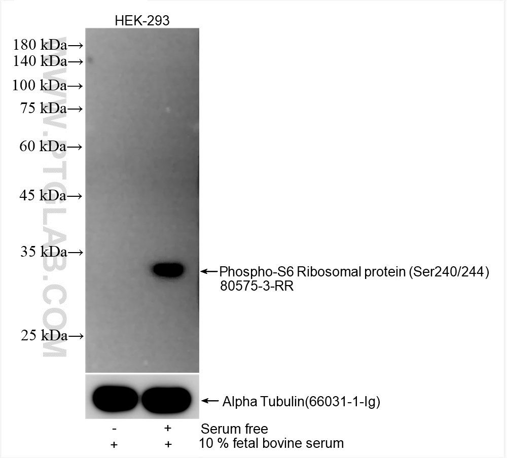 Western Blot (WB) analysis of various lysates using Phospho-S6 Ribosomal protein (Ser240/244) Recombin (80575-3-RR)