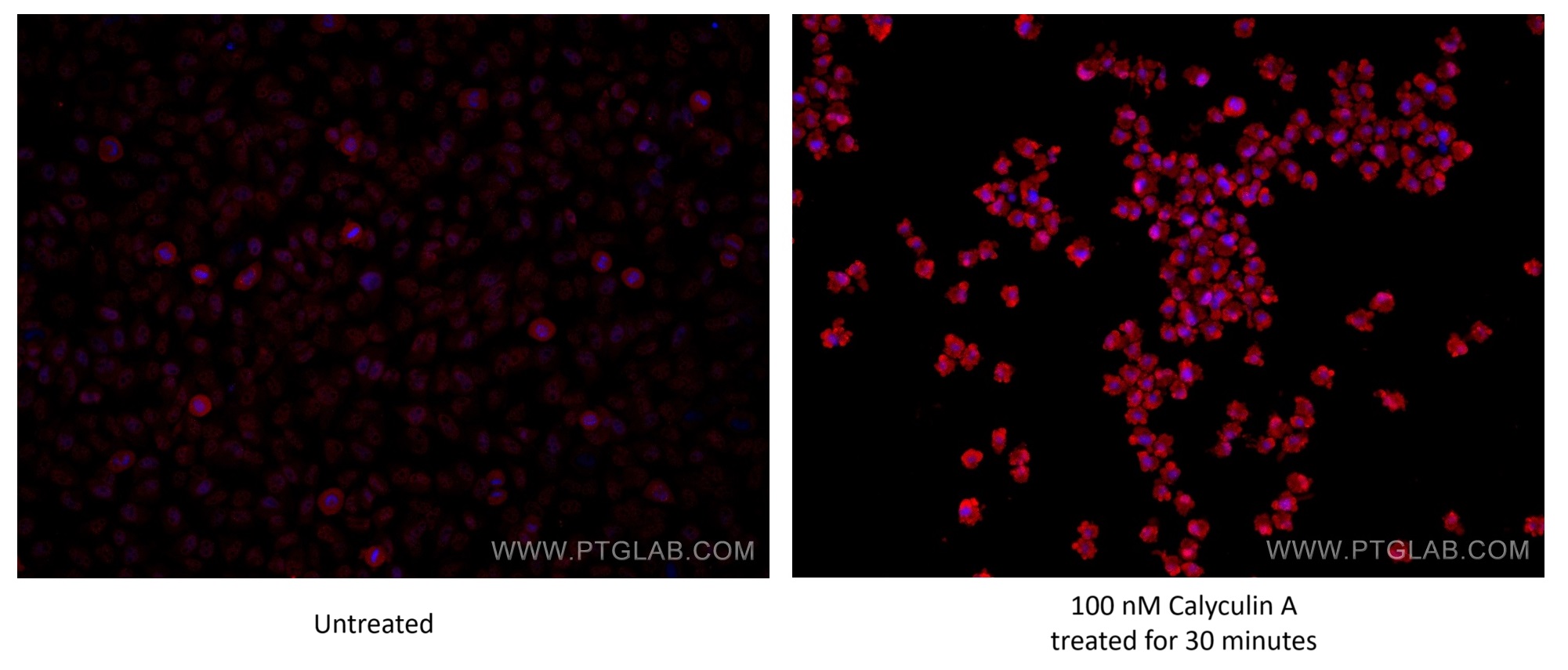 Immunofluorescence (IF) / fluorescent staining of HeLa cells using Phospho-S6 Ribosomal protein (Ser240/244) Recombin (81184-1-RR)