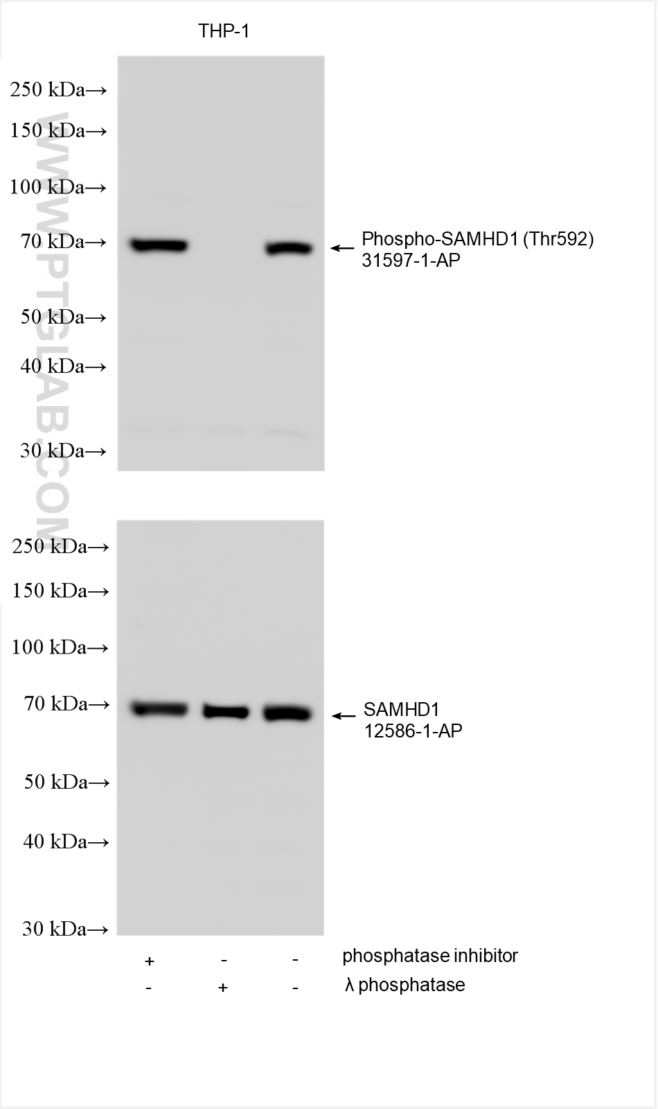 Western Blot (WB) analysis of various lysates using Phospho-SAMHD1 (Thr592) Polyclonal antibody (31597-1-AP)