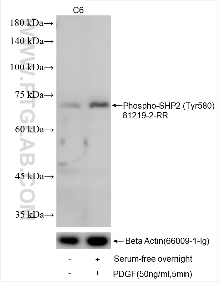 Western Blot (WB) analysis of various lysates using Phospho-SHP2 (Tyr580) Recombinant antibody (81219-2-RR)