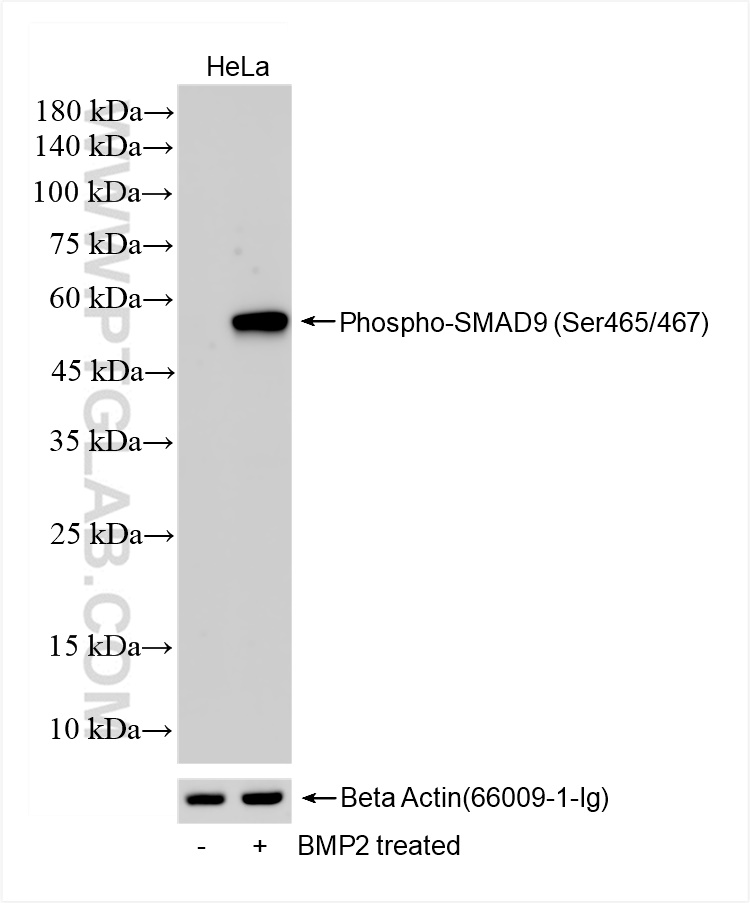 Phospho-SMAD9 (Ser465/467)